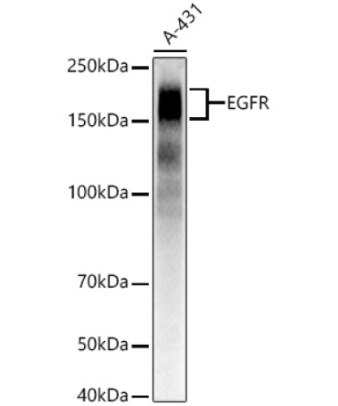 EGFR Rabbit Monoclonal Antibody
