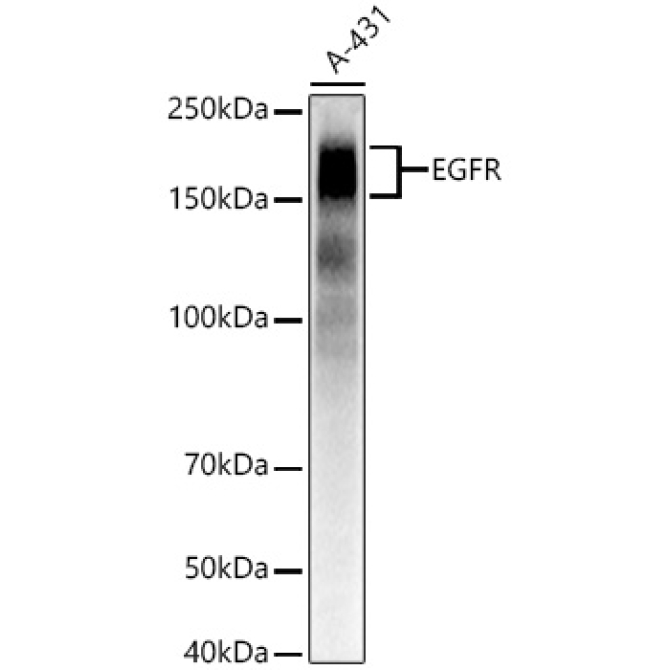 EGFR Rabbit Monoclonal Antibody
