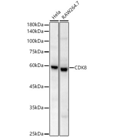 CDK8 Rabbit Monoclonal Antibody