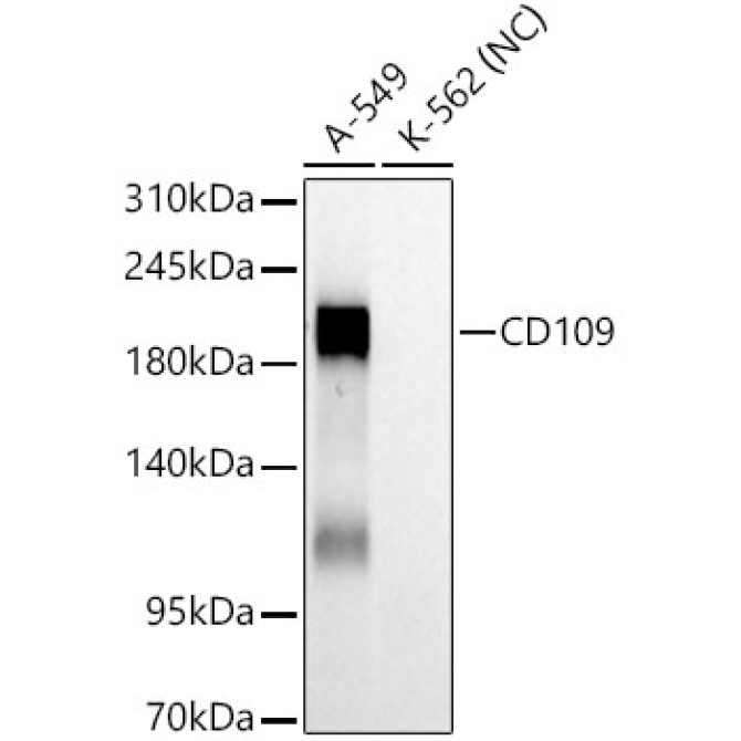 CD109 Rabbit Monoclonal Antibody
