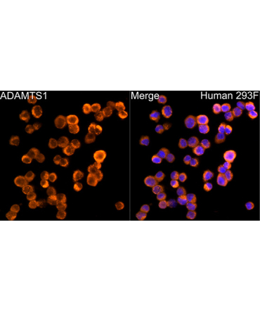 ADAMTS1 Rabbit Monoclonal Antibody