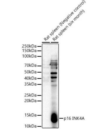 p16 INK4A Rabbit Polyclonal Antibody