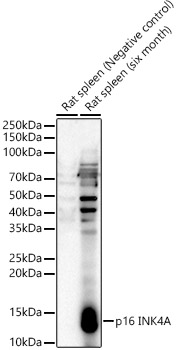 p16 INK4A Rabbit Polyclonal Antibody
