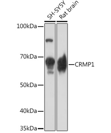 CRMP1 Rabbit Monoclonal Antibody