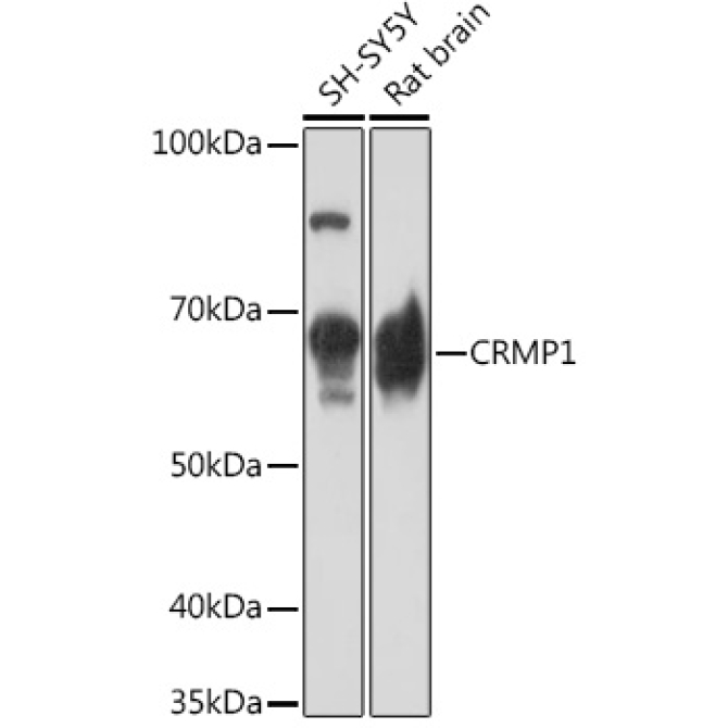 CRMP1 Rabbit Monoclonal Antibody