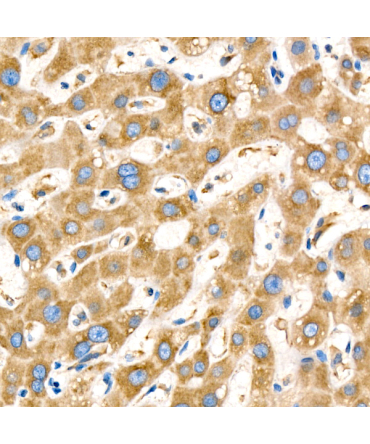 LYRIC/AEG1 Rabbit Monoclonal Antibody