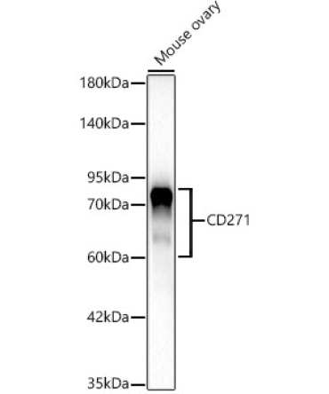 CD271 Rabbit Monoclonal Antibody