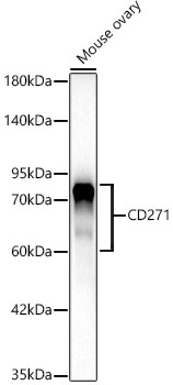 CD271 Rabbit Monoclonal Antibody
