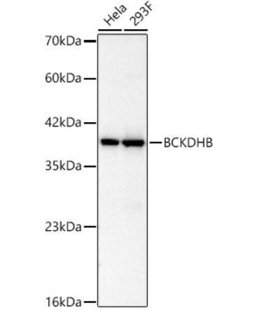BCKDHB Rabbit Monoclonal Antibody