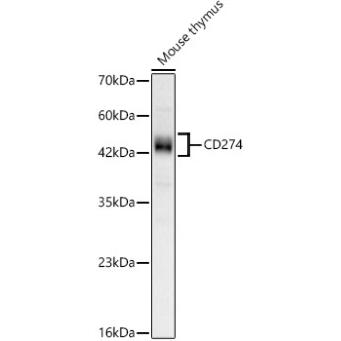 CD274 Rabbit Monoclonal Antibody