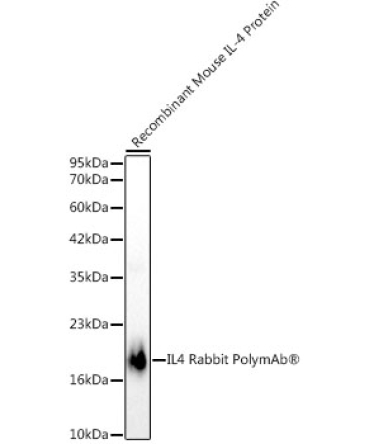 IL4 Rabbit PolyMonoclonal Antibody?