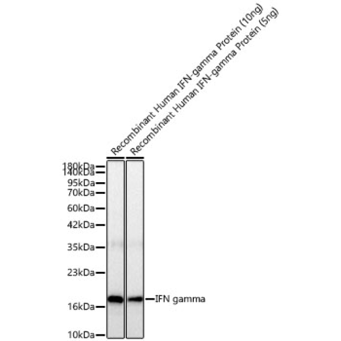 IFN gamma Rabbit Monoclonal Antibody