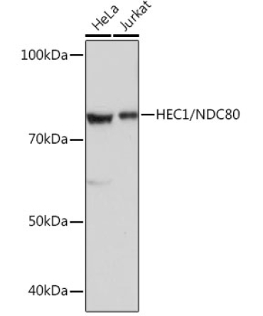HEC1/NDC80 Rabbit Monoclonal Antibody