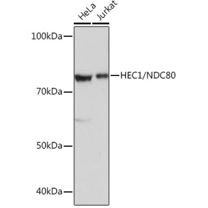 HEC1/NDC80 Rabbit Monoclonal Antibody