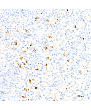 Myeloperoxidase (MPO) Rabbit Monoclonal Antibody