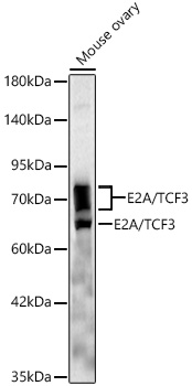 E2A/TCF3 Rabbit Monoclonal Antibody