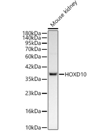 HOXD10 Rabbit Monoclonal Antibody