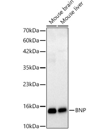BNP Rabbit Monoclonal Antibody