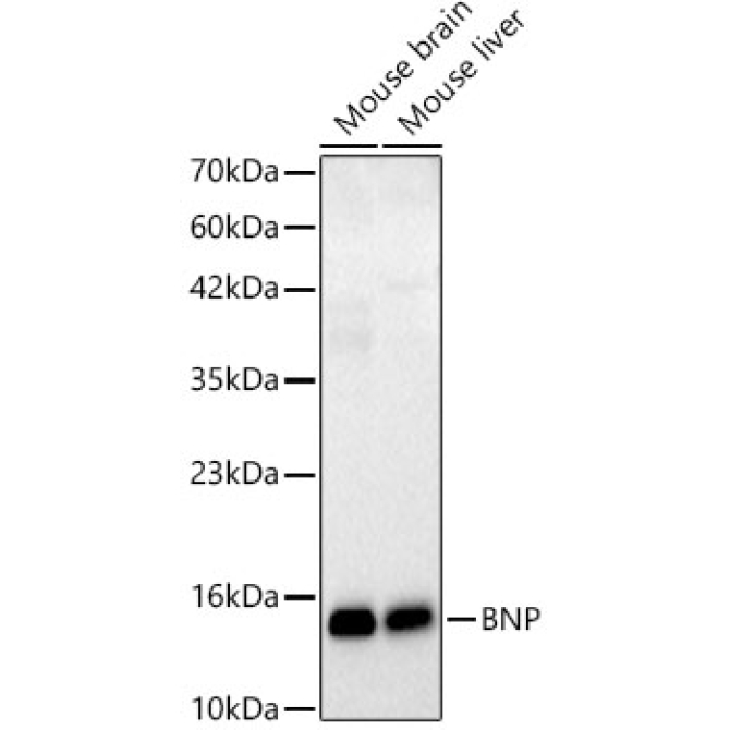 BNP Rabbit Monoclonal Antibody