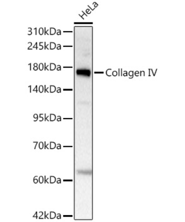 Collagen IV Rabbit Monoclonal Antibody