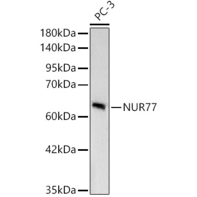 NUR77 Rabbit Monoclonal Antibody [KD Validated]
