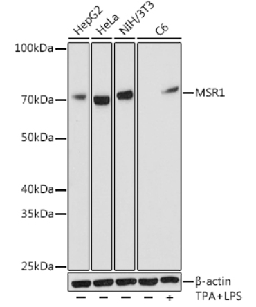 MSR1 Rabbit Monoclonal Antibody