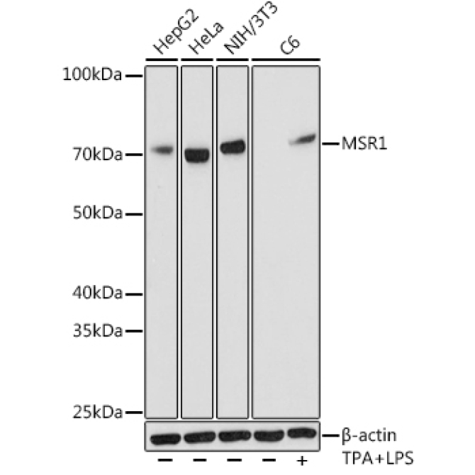 MSR1 Rabbit Monoclonal Antibody