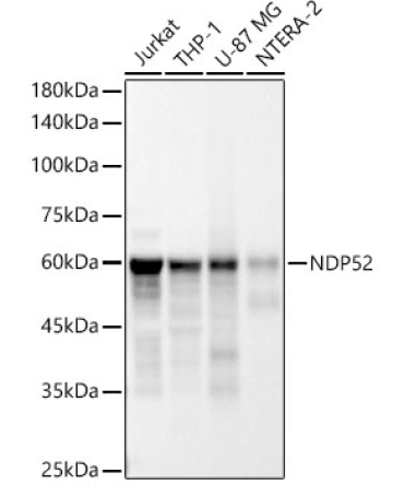 NDP52 Rabbit Monoclonal Antibody