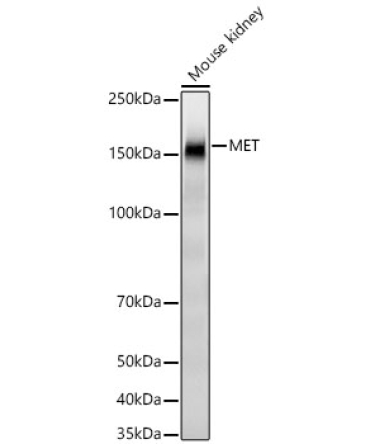 MET Rabbit Monoclonal Antibody