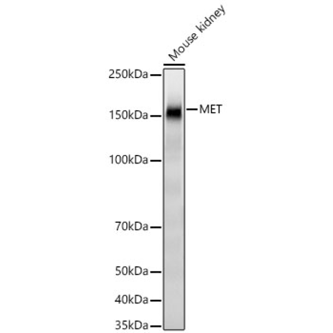 MET Rabbit Monoclonal Antibody