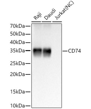 CD74 Rabbit Monoclonal Antibody