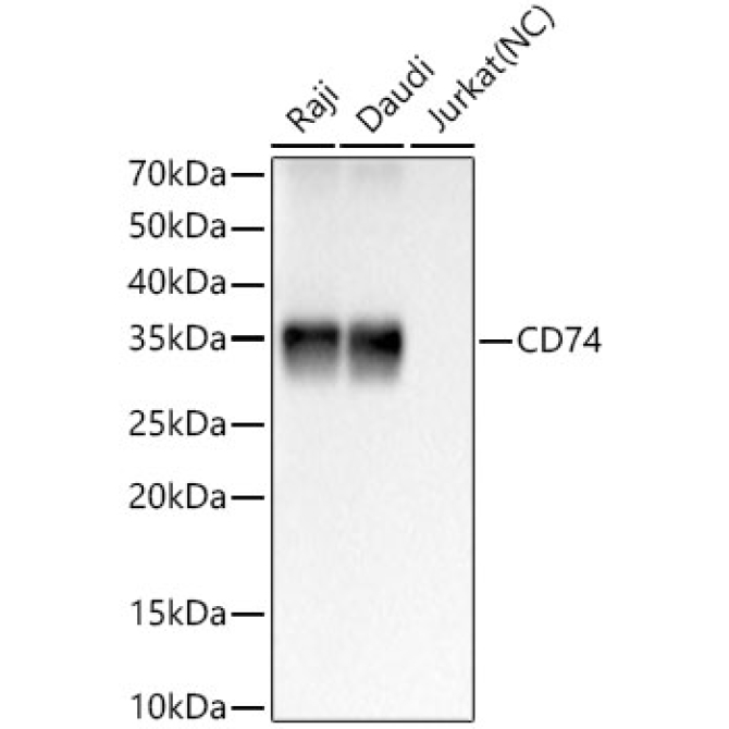 CD74 Rabbit Monoclonal Antibody