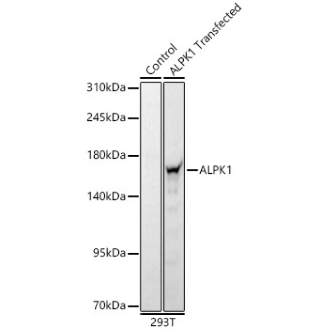 ALPK1 Rabbit Polyclonal Antibody