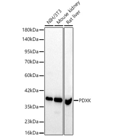 PDXK Rabbit Polyclonal Antibody [KD Validated]