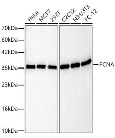 PCNA Mouse Monoclonal Antibody