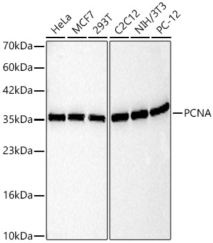 PCNA Mouse Monoclonal Antibody