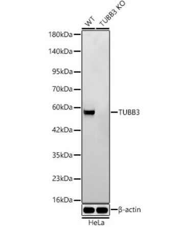 BetaIII-Tubulin Rabbit Monoclonal Antibody [KO Validated]