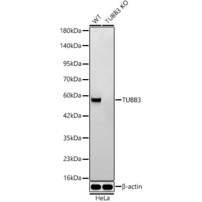 BetaIII-Tubulin Rabbit Monoclonal Antibody [KO Validated]