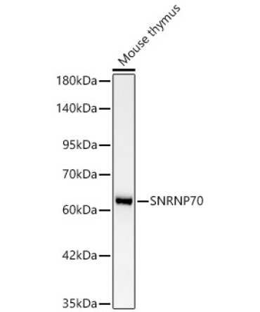 SNRNP70 Rabbit Monoclonal Antibody [KD Validated]