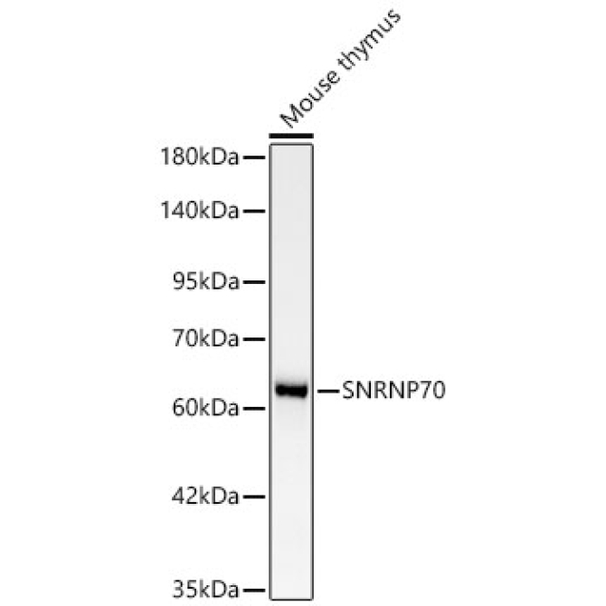 SNRNP70 Rabbit Monoclonal Antibody [KD Validated]