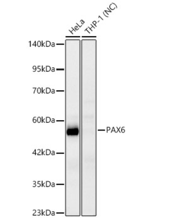 PAX6 Rabbit Monoclonal Antibody