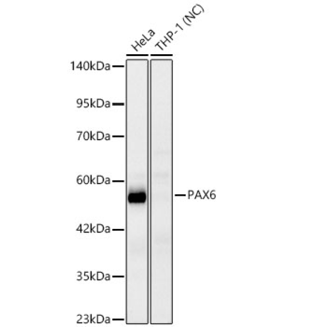 PAX6 Rabbit Monoclonal Antibody