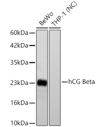 hCG Beta Rabbit Monoclonal Antibody