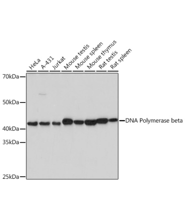 DNA Polymerase beta Rabbit Monoclonal Antibody