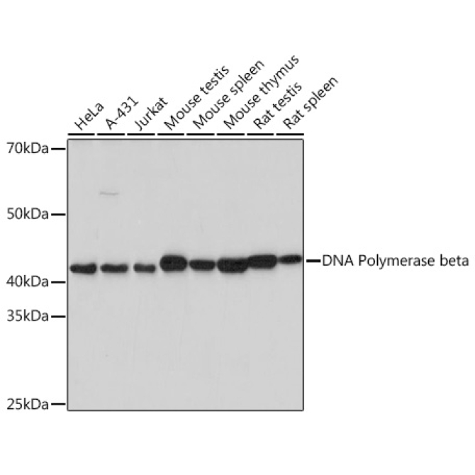 DNA Polymerase beta Rabbit Monoclonal Antibody
