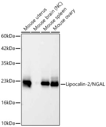 Lipocalin-2/NGAL Rabbit Monoclonal Antibody