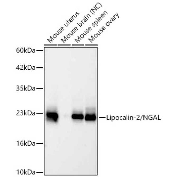 Lipocalin-2/NGAL Rabbit Monoclonal Antibody