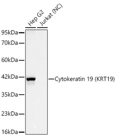Cytokeratin 19 (KRT19) Rabbit Monoclonal Antibody