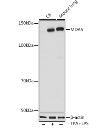 MDA5 Rabbit Monoclonal Antibody