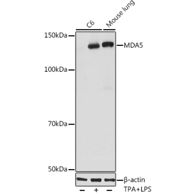 MDA5 Rabbit Monoclonal Antibody
